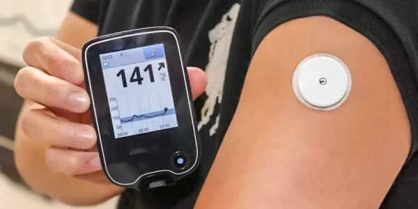 Continuous Glucose Monitoring